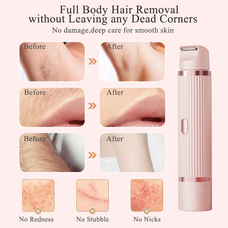 Ultra Sensitive Epilator for Intimate Parts